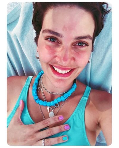 Bergüzar Korel seksi ifşa fotoğrafı 94